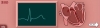 Electrocardiogram game image