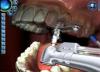 Dental Implant Training Simulation