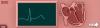 Electrocardiogram